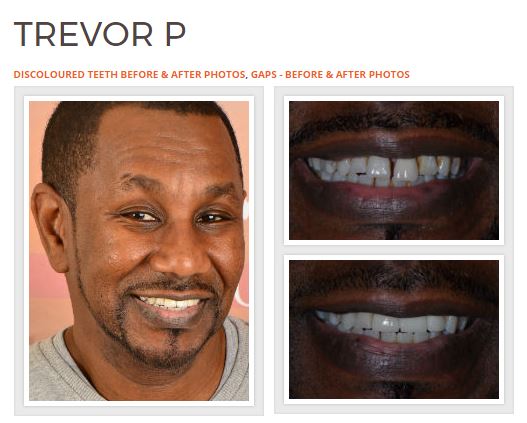 Dr Rahul Doshi Smile Make-Over Expert