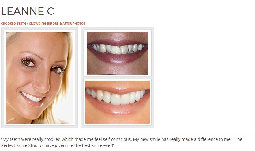 Dr Rahul Doshi Smile Make-Over Expert