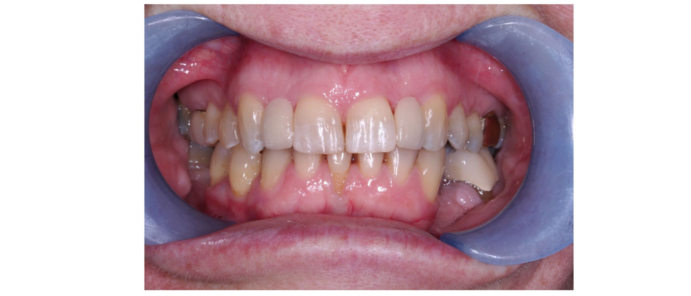 case7 - after treatment
