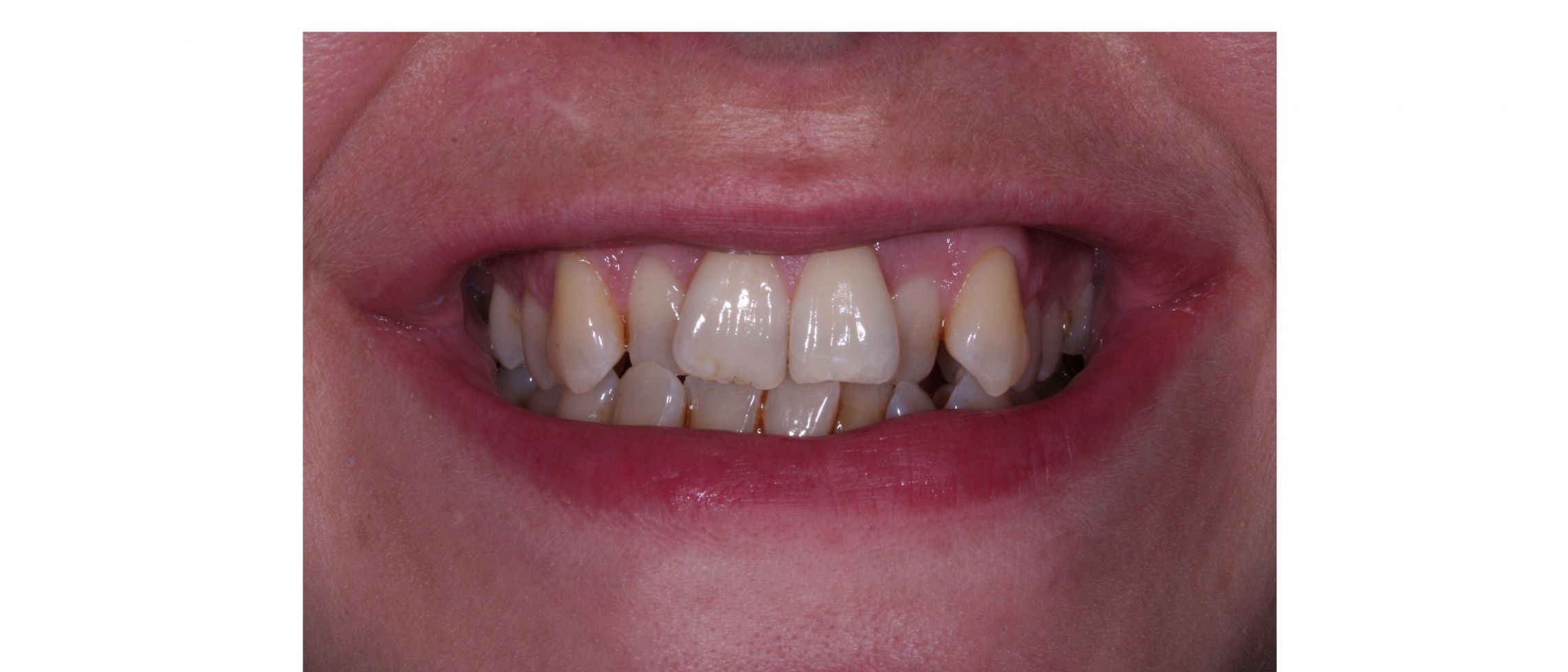Case1 - before treatment