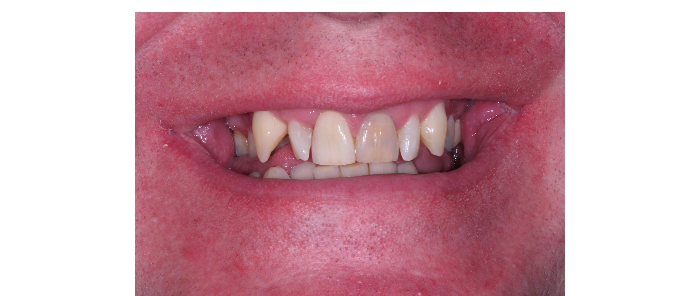 case4 - before treatment