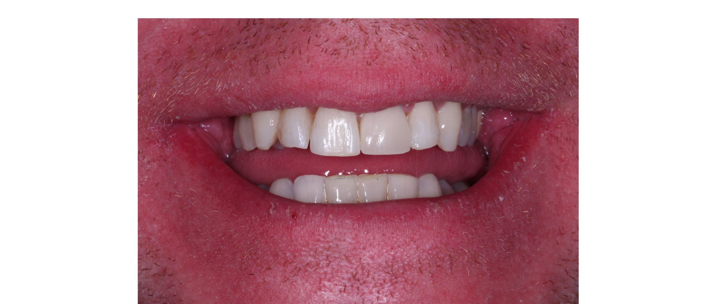 case4 - after treatment