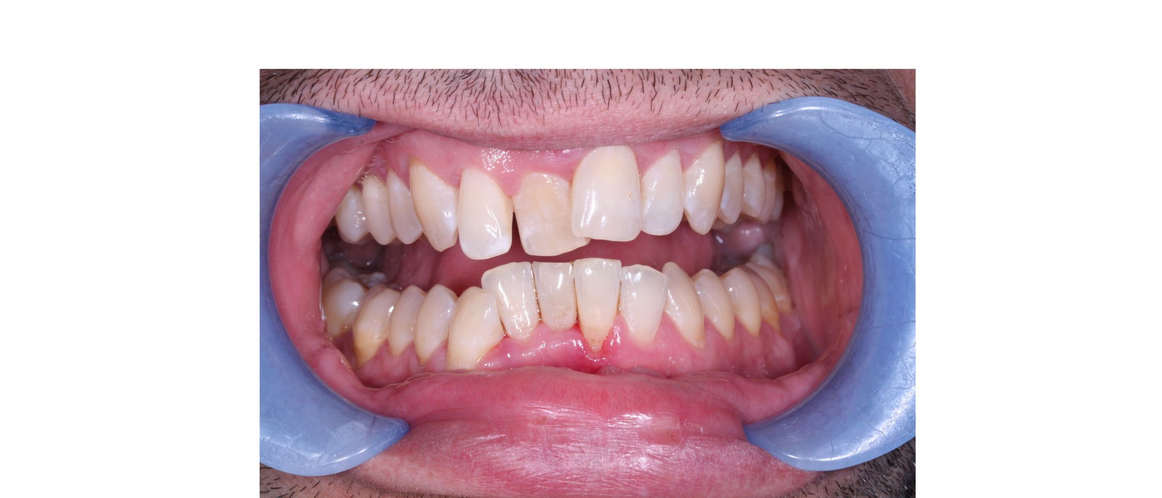 case6 - before treatment