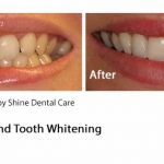 Shine Dental Care Ltd 