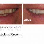 Shine Dental Care Ltd 