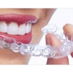 Clear adult braces - why not!