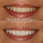 Simple Whitening