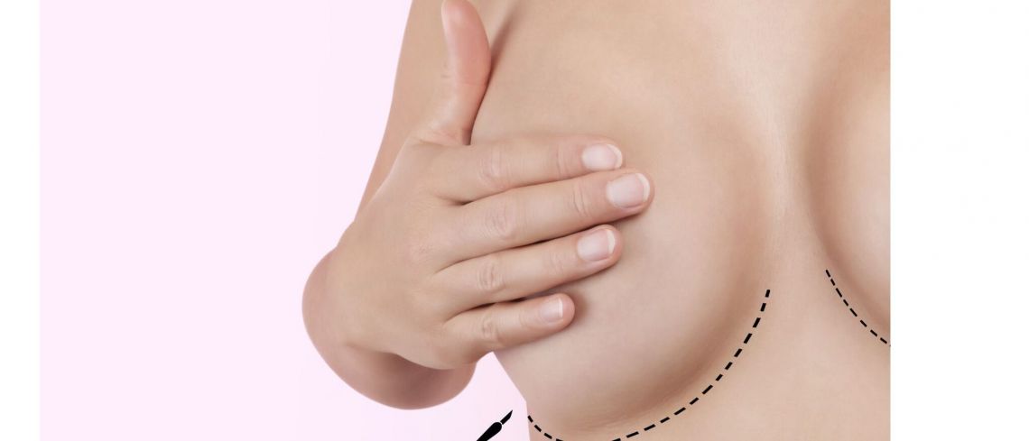 When should I replace my breast implants?