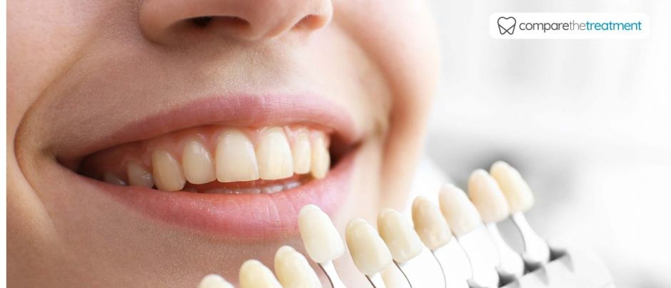 How to keep a healthy smile | Comparethetreatment.com