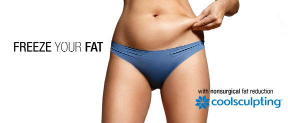 CoolSculpting